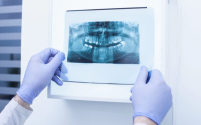 Can Diseases Cause Oral Health Problems?