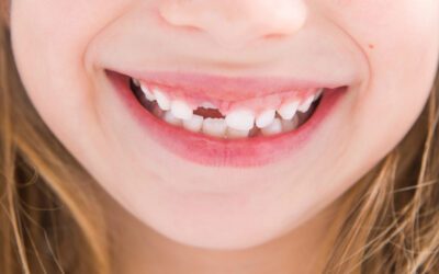 Restorative Dentistry for Kids: Why Baby Teeth Matter, Too