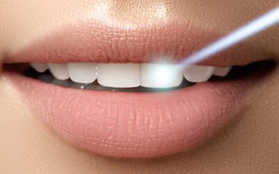 5 Reasons to Try Laser Teeth Whitening in Homewood, IL, Today