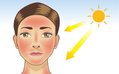 Dentist in Homewood Explains Sun Damage, Lip Cancer, and the Importance of UV Protection