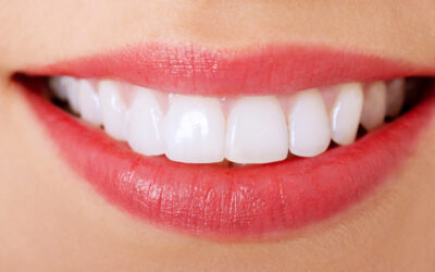 How Cosmetic Dentistry Advancements Are Making Hollywood Smiles More Accessible