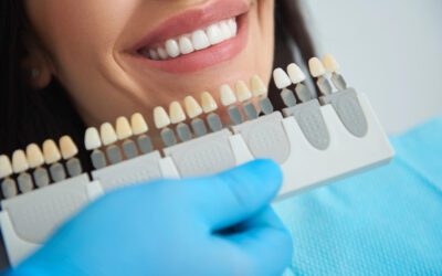 Getting Veneers in Your 20s vs. Your 50s: Is There a Best Time?