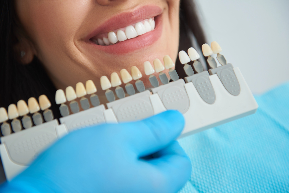 dentist holding up different veneers tooth shades up to patient's mouth