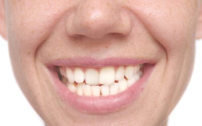 Embarrassed About My Oral Health: A Reassuring Visit with Your Dentist in Homewood
