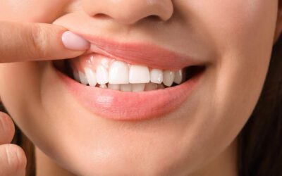 Are My Gums Receding, or Are My Teeth Sensitive?