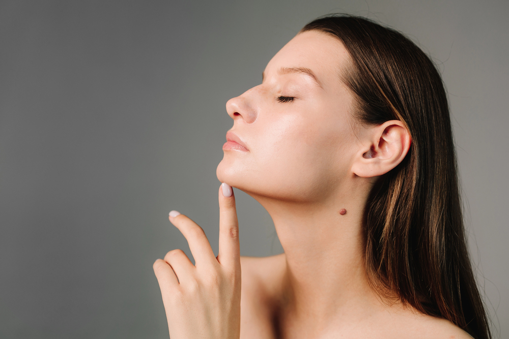 woman with improved face shape because of Invisalign