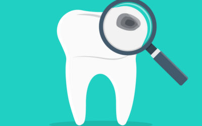 Think You Don’t Have Cavities? These Hidden Signs Say Otherwise
