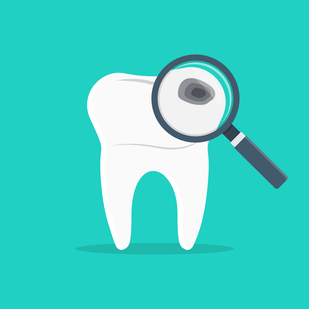 Teeth inspection with magnifying glass dental examination Tooth being examined with a magnifying glass, symbolizing a dental checkup or inspection