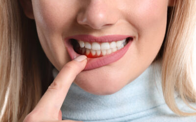 Why Are My Teeth Suddenly Sensitive? 8 Common Causes You Shouldn’t Ignore