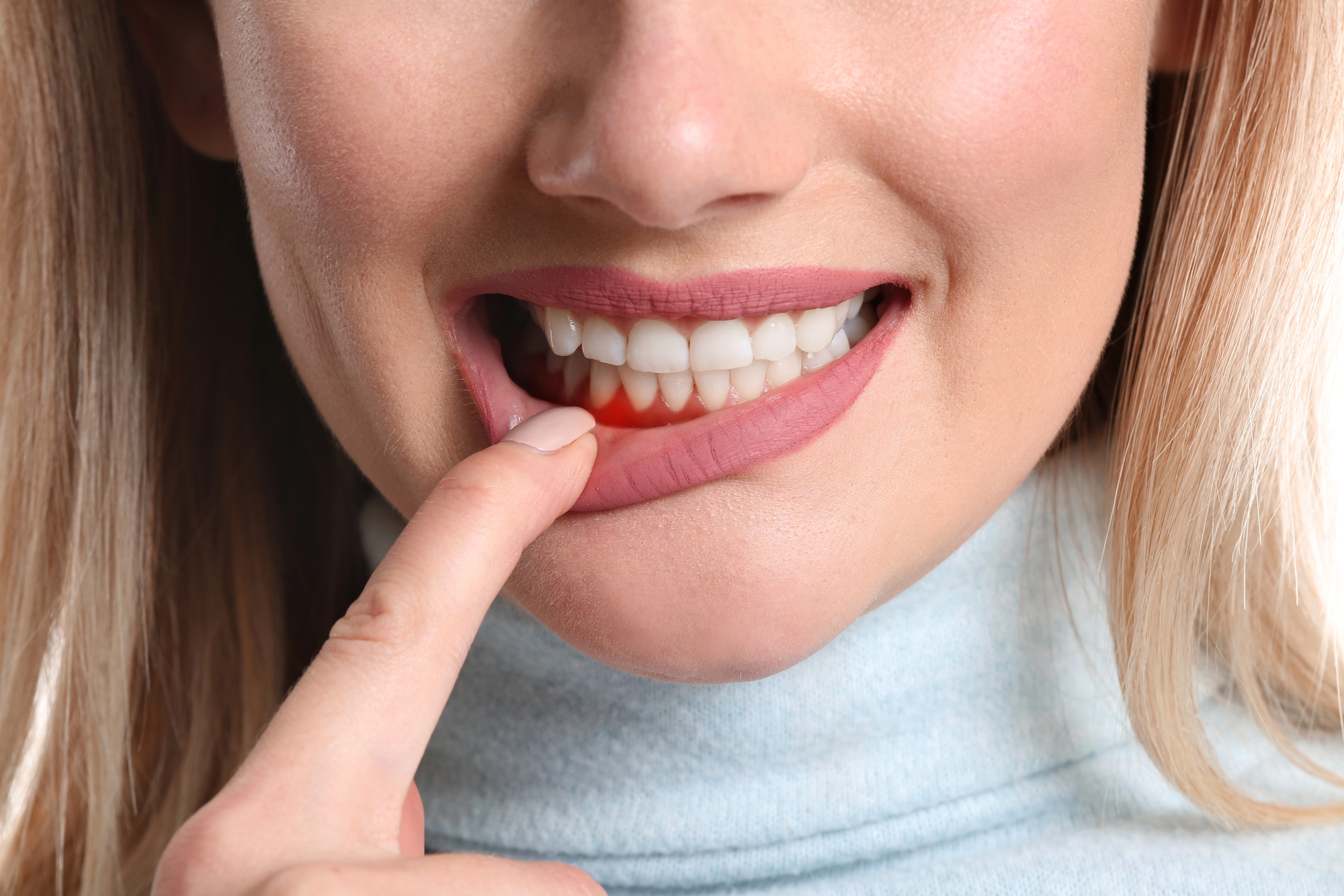 red, inflamed gums can cause tooth sensitivity red, inflamed gums can cause tooth sensitivity