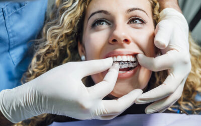 Why Invisalign® Might Be the Smartest Cosmetic Dental Choice You Can Make